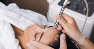 white woman getting microdermabrasion facial